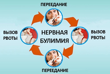 Лечение булимии в Ивановском